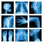 stock market x-ray