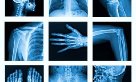 stock market x-ray