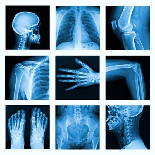 stock market x-ray