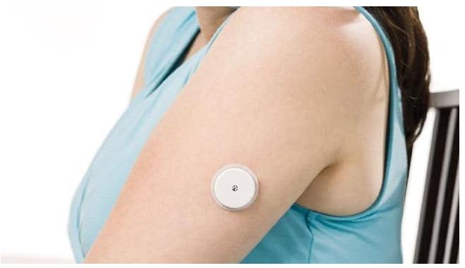 Glucose Monitoring Device - Arm