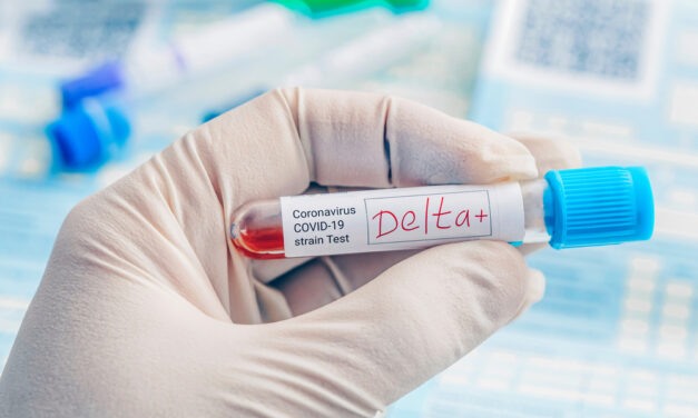 The Market Is Pricing in the Delta Variant Risk